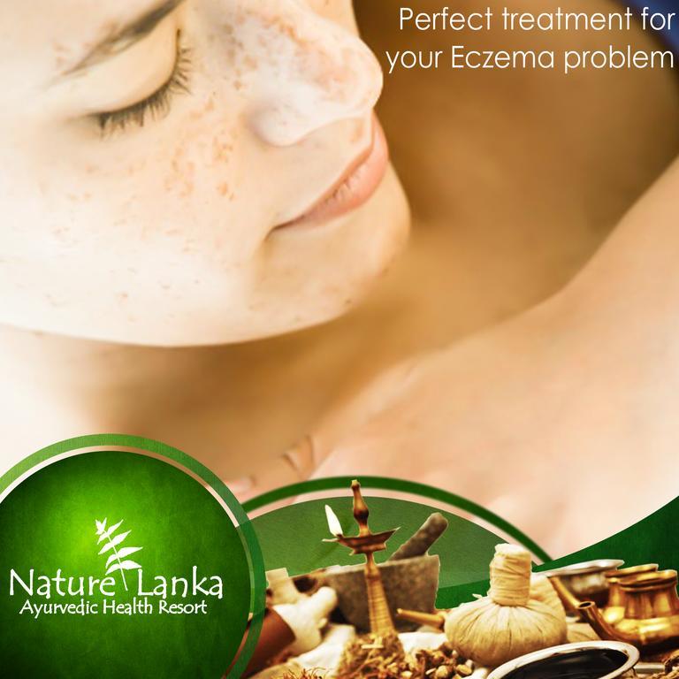 Nature Lanka Ayurveda Resort - All Meals And Ayurveda Treatments With Yoga تانجالي المظهر الخارجي الصورة